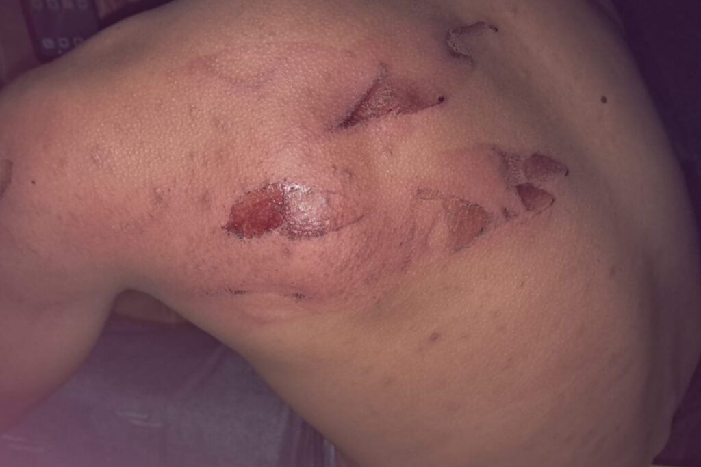 encontro-do-terror:-homem-e-espancado-apos-marcar-date-por-aplicativo