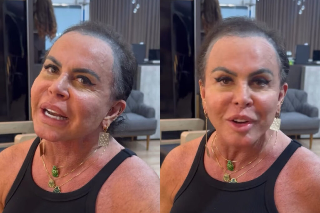 gretchen-aparece-sem-protese-capilar-e-revela-destino-de-cabelo