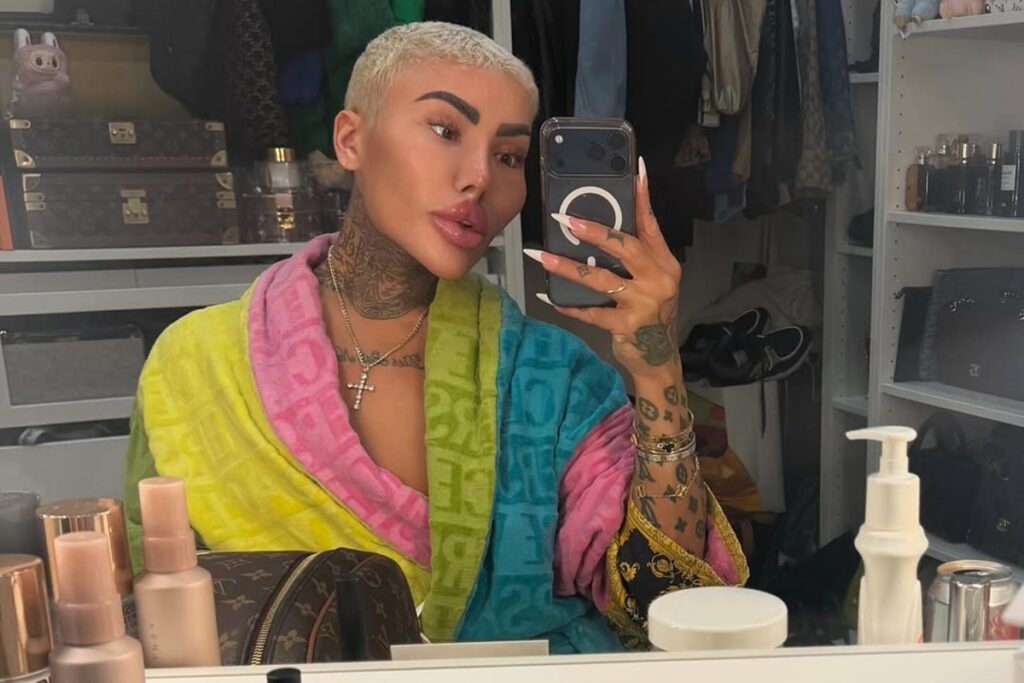 quem-era-jordan-james-parke,-o-“rei-dos-labios”-de-botched