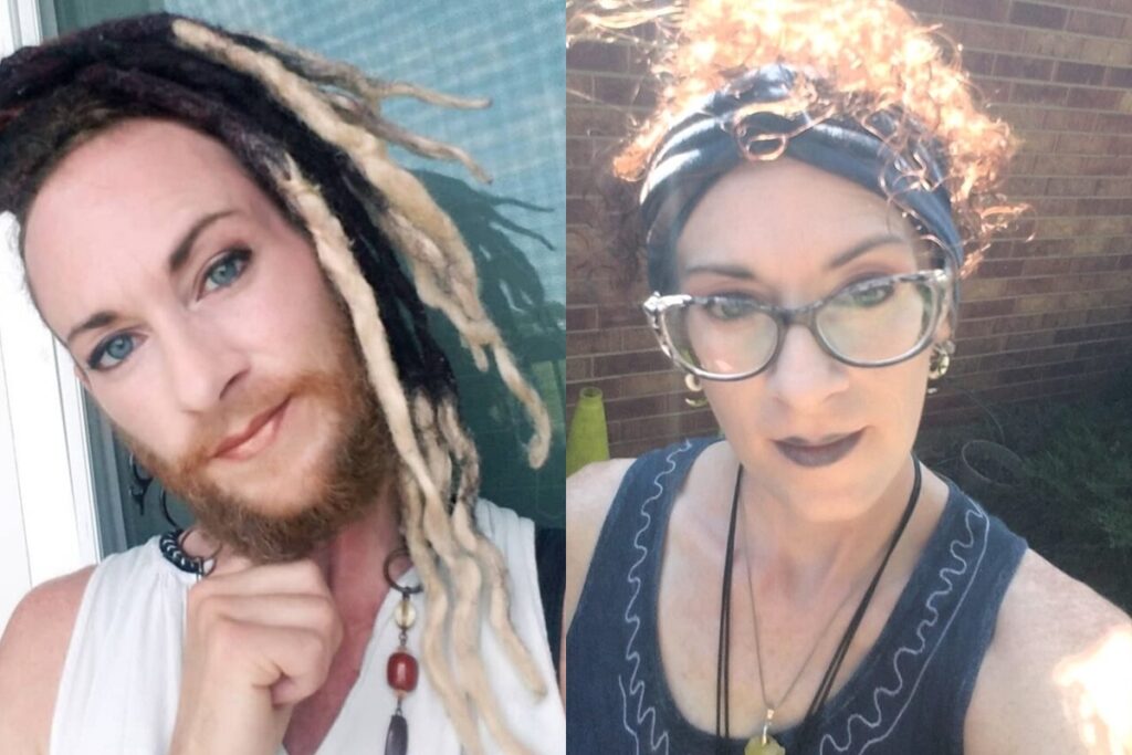 empoderamento:-apos-anos-sofrendo-com-depilacao,-mulher-assume-barba