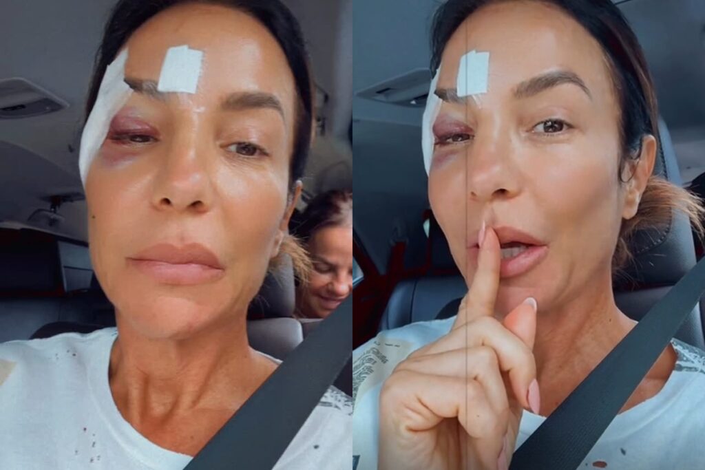 ivete-sangalo-atualiza-estado-de-saude-apos-desmaio-e-internacao.-veja-o-video