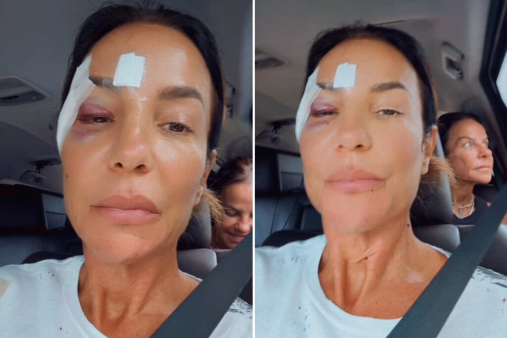 ivete-sangalo-deixa-hospital-apos-diagnostico;-saiba-o-que-aconteceu