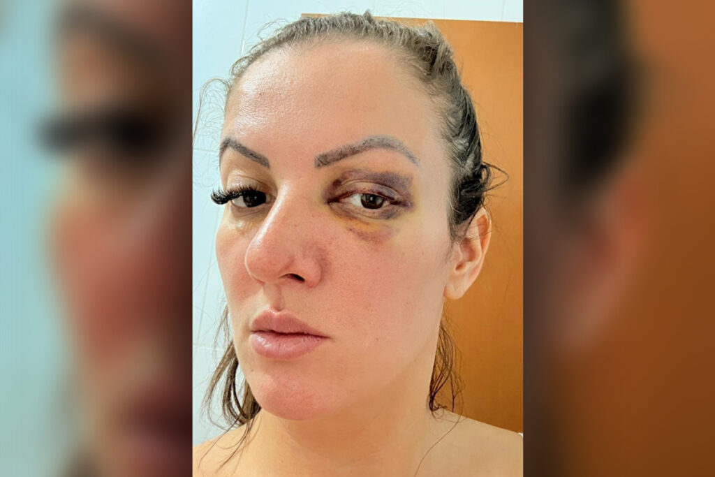 vereadora-que-atropelou-namorado-em-sp-apos-agressao-se-manifesta.-veja-video