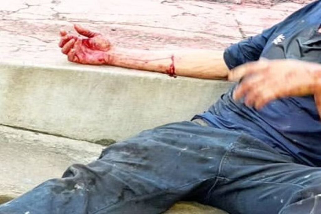 homem-e-brutalmente-espancado-e-fica-coberto-de-sangue-no-df