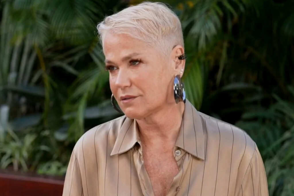 por-que-famosas-estao-deixando-o-botox-de-lado?-especialistas-analisam