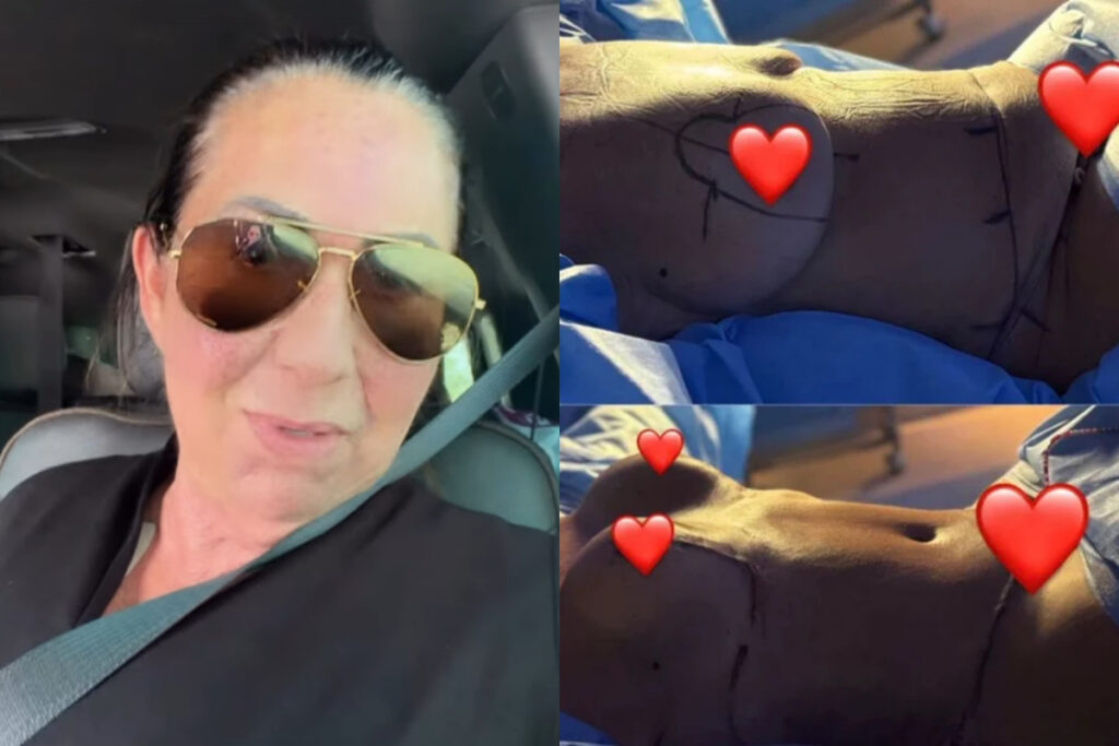 mae-de-virginia-recebe-alta-apos-plasticas:-“tudo-maravilhoso”.-veja-video