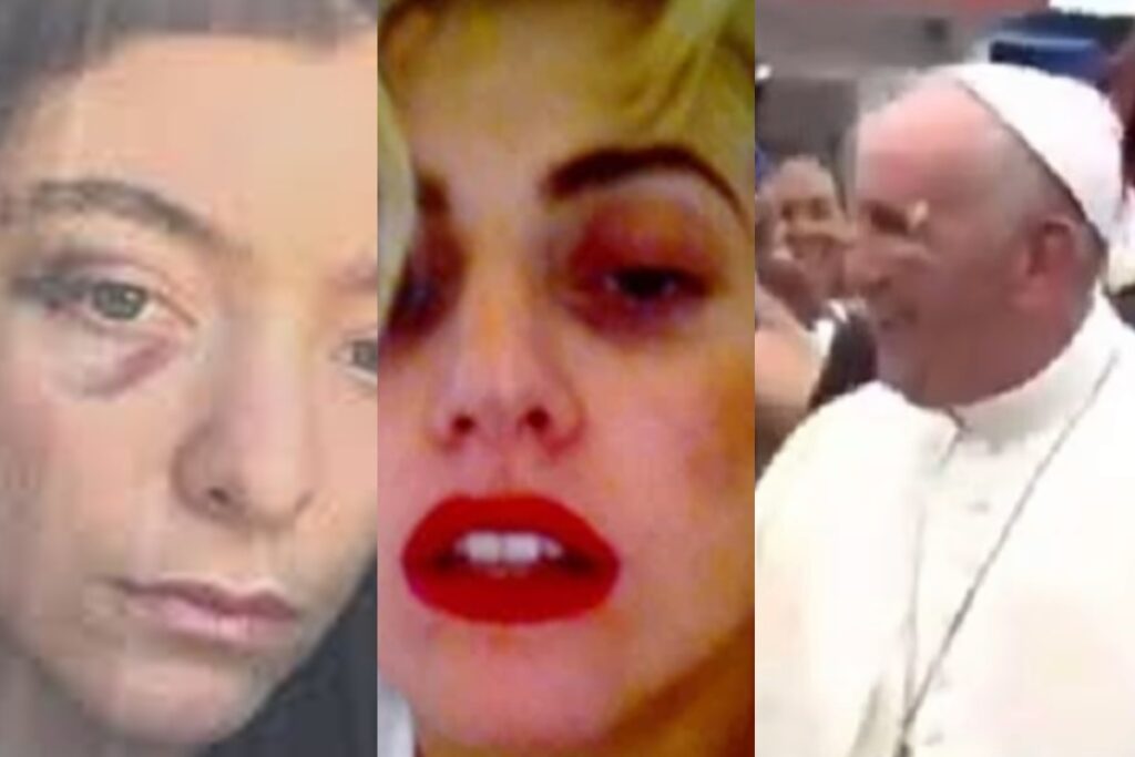 “clube-do-olho-roxo”:-entenda-a-teoria-que-envolve-famosos-e-lideres-mundiais