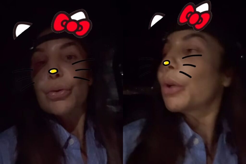 ivete-sangalo-volta-a-salvador-apos-cirurgia-e-desabafa:-“fogo”