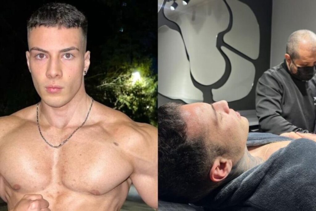 ex-fisiculturista-quebra-mito-sobre-orgao-apos-harmonizacao-intima