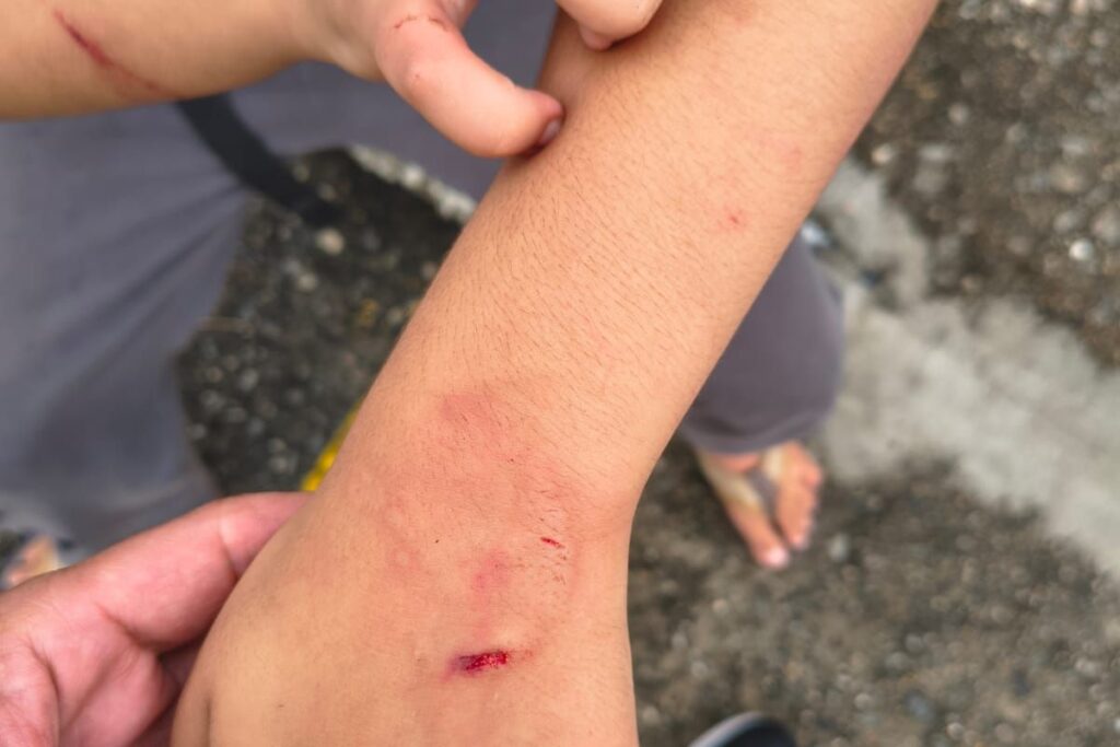 mulher-e-presa-suspeita-de-agredir-filho-de-9-anos-com-chave-de-fenda