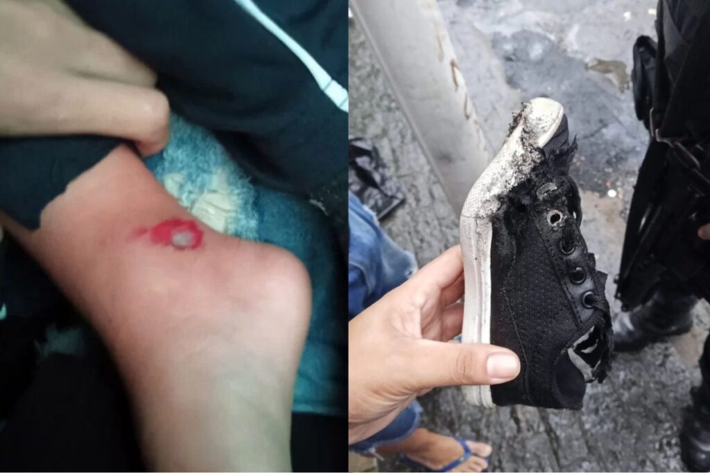 pm-atropela-crianca-de-3-anos-e-xinga-a-mae-de-“puta”-em-saida-de-creche.-video