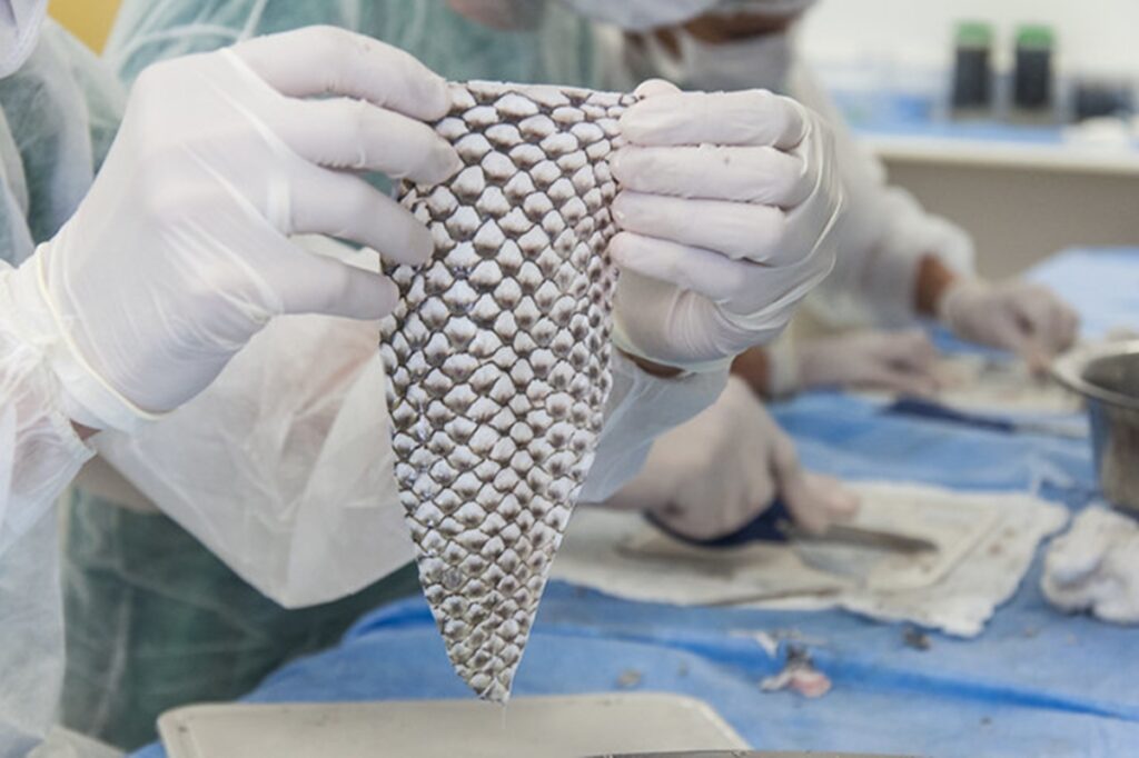 100%-brasileira:-tecnica-com-pele-de-tilapia-vai-alem-de-queimaduras