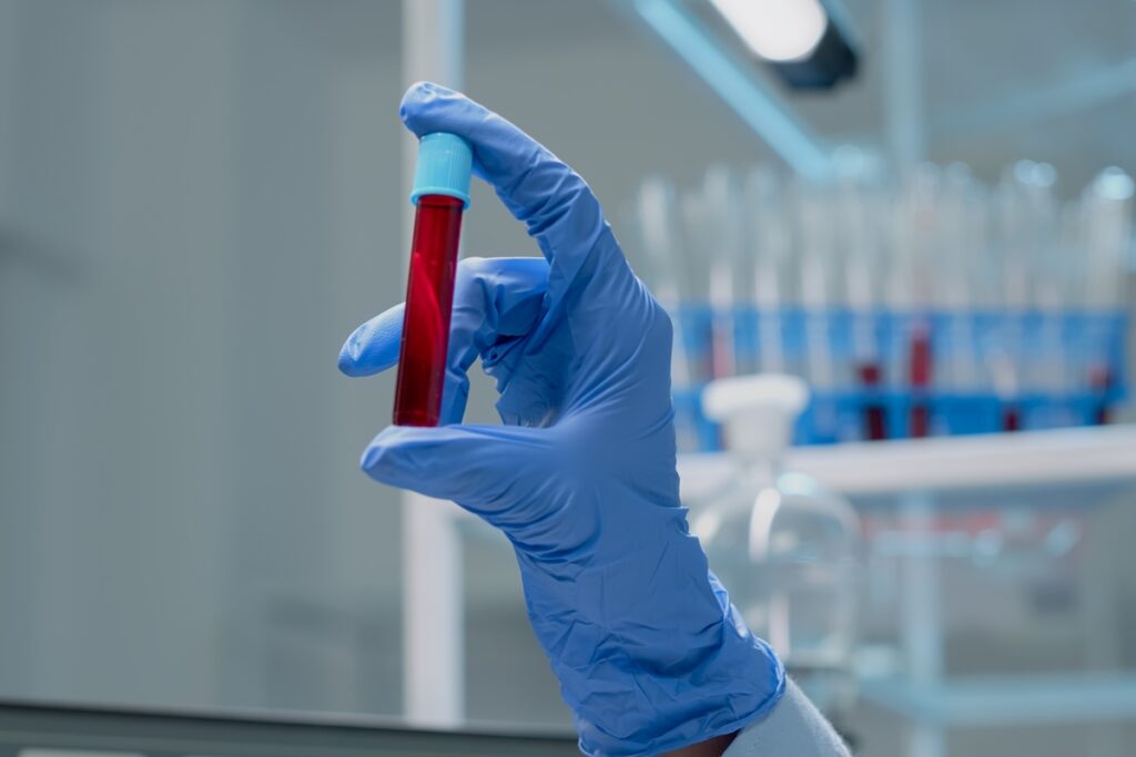 estudo-brasileiro-cria-exame-de-sangue-para-detectar-cancer-de-mama