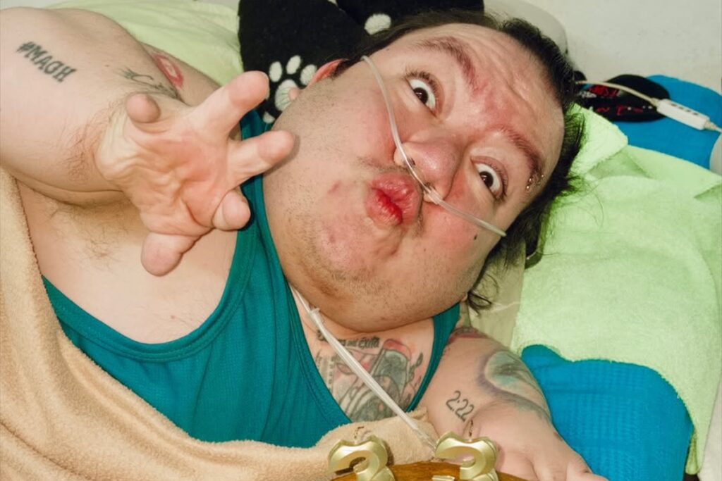 morre-alejo-little,-conhecido-como-um-dos-menores-influencers-do-mundo