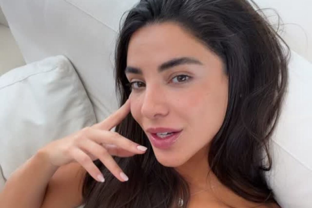 gabriela-versiani-desabafa-apos-acidente-domestico:-“olho-gordo”.-video