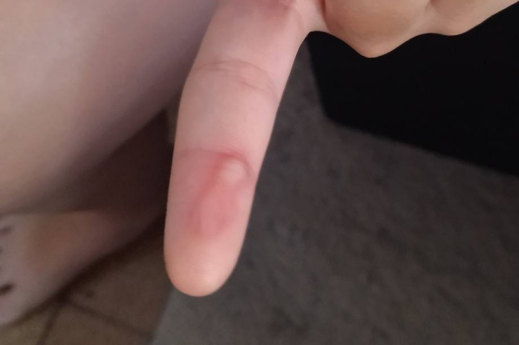 maes-denunciam-professora-suspeita-de-queimar-os-dedos-de-criancas