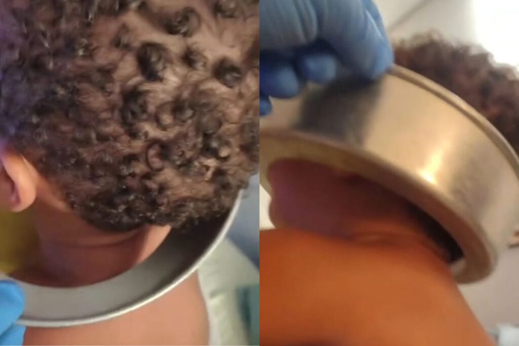 “menino-maluquinho-da-baixada”:-bebe-prende-cabeca-em-forma-de-bolo