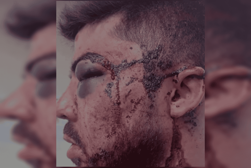 caso-de-rapper-espancado-por-10-em-bar-da-asa-norte-sofre-reviravolta