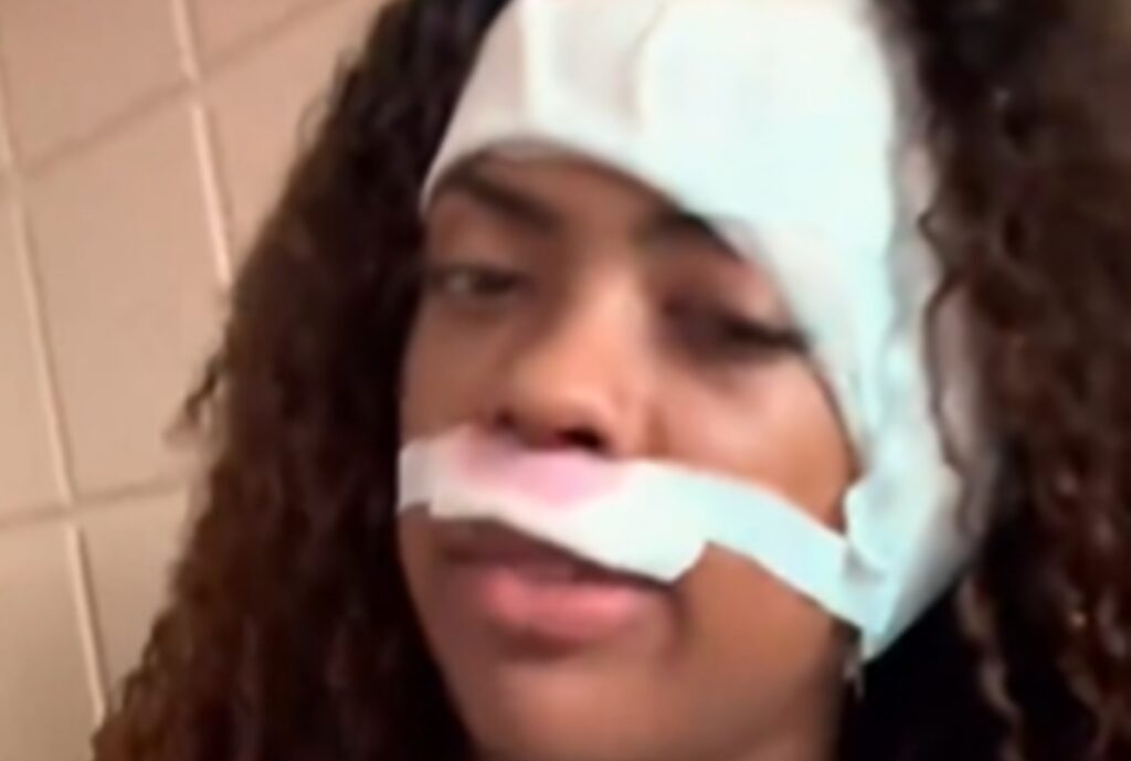 cantora-marvvila-passa-por-cirurgia-apos-descobrir-tumor