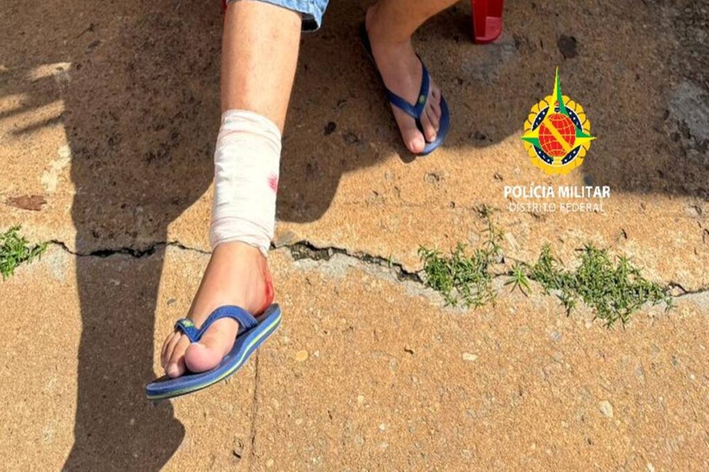 pit-bull-e-morto-pela-pm-apos-atacar-pessoas-e-matar-cadela-no-df