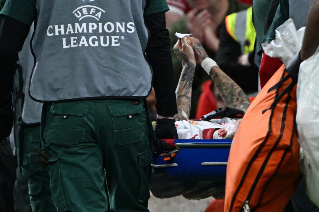 uefa-vai-analisar-paineis-de-led-apos-atleta-ter-dedo-quase-decepado