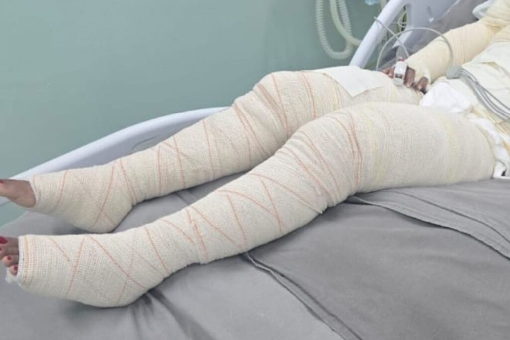 homem-e-preso-apos-ataque-que-deixou-mulher-com-80%-do-corpo-queimado