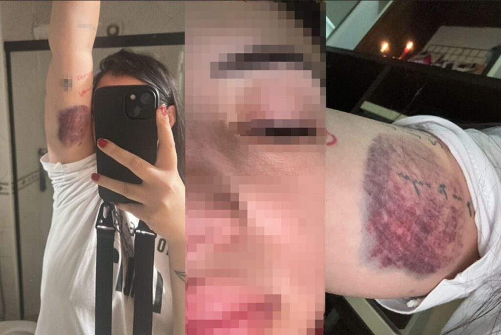 mulher-espancada-em-carro-de-app-e-ameacada-de-morte:-“vai-pro-saco”