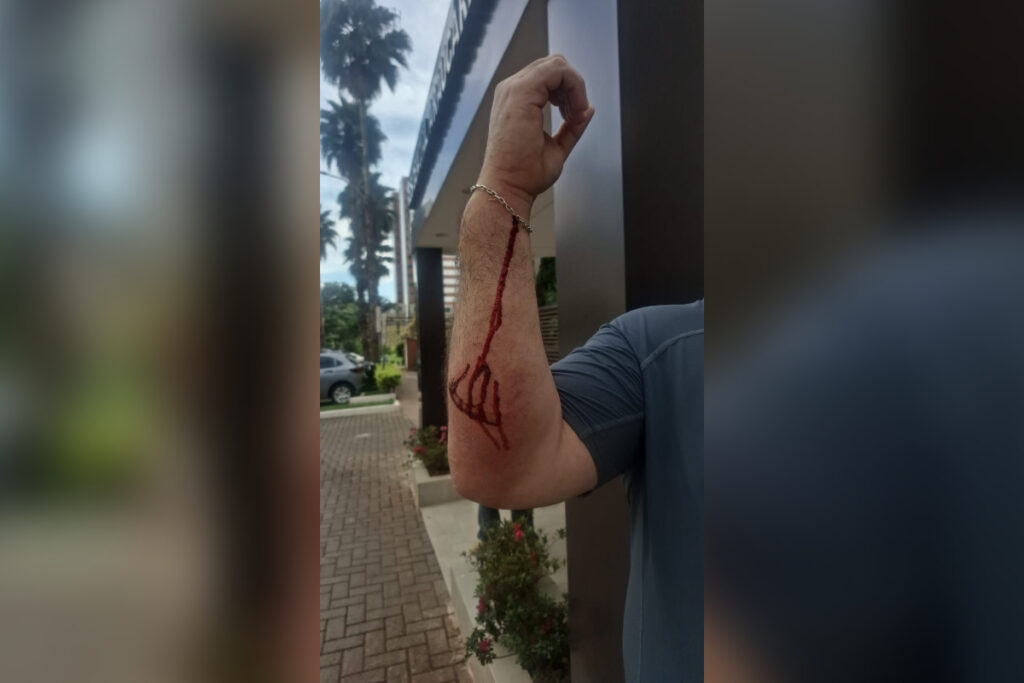 morador-de-rua-morto-em-aguas-claras-tinha-historico-de-agressoes