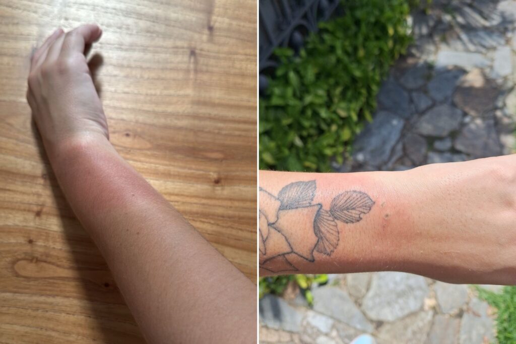 fas-relatam-queimaduras-por-pulseiras-apos-show-de-luan-santana-em-bh