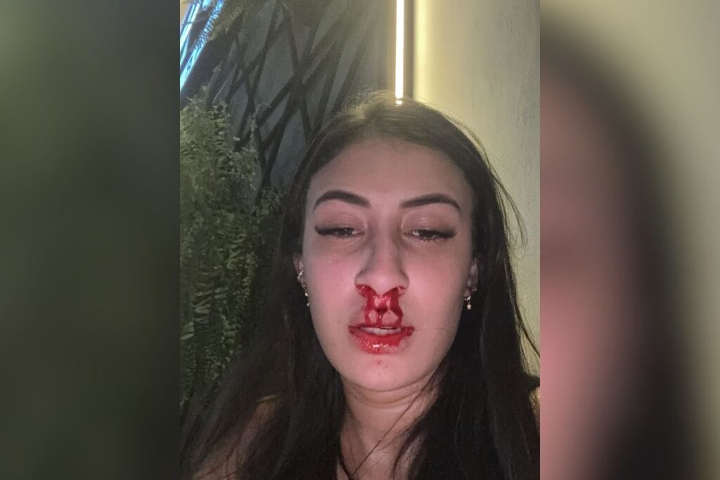 “nada-justifica”:-jovem-diz-que-levou-soco-de-ficante-e-apagou-em-bar