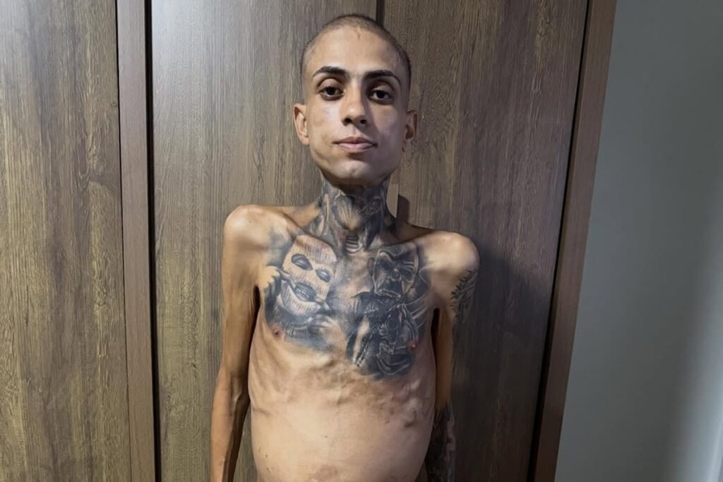 influenciador-jota-surfista-morre-apos-diagnostico-de-cancer