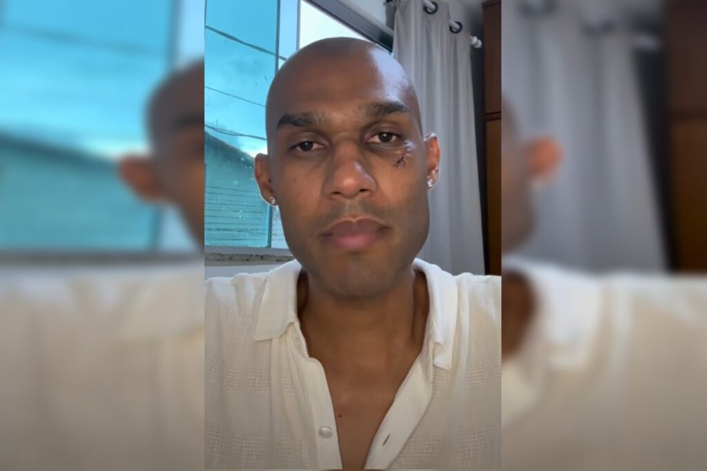 advogado-e-agredido-em-bar-no-df-por-militares-do-exercito-apos-racismo.-veja-video