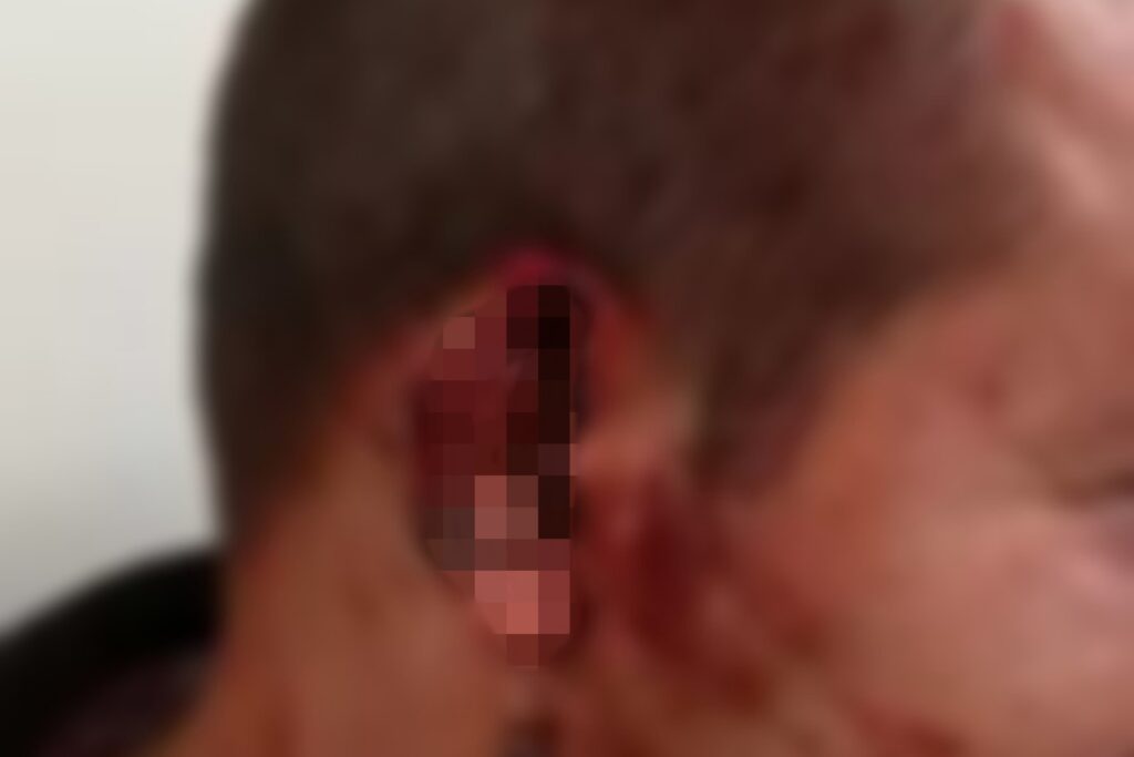 mulher-acusada-de-arrancar-orelha-de-homem-e-jogar-no-lixo-e-presa