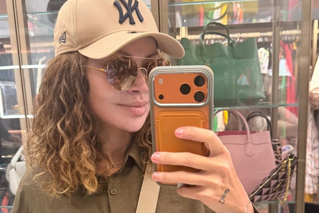 mudanca-de-solange-almeida-levanta-debate-sobre-procedimentos-faciais