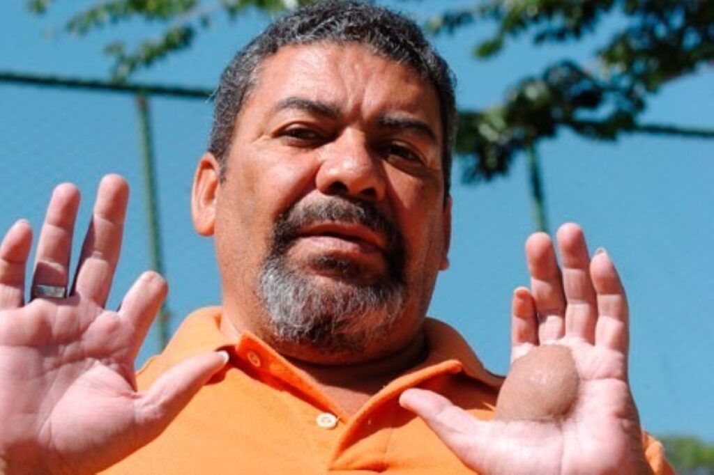 vitima-do-cesio-critica-netflix:-historia-real-“foi-tragica-por-si-so”