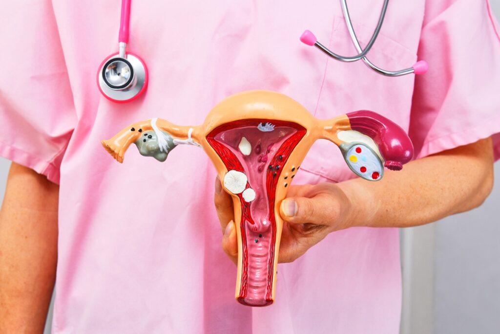 o-que-falta-para-um-acesso-mais-rapido-ao-diagnostico-de-endometriose?