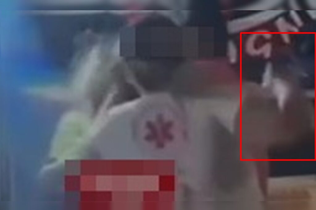 porrada-no-hugol:-funcionaria-do-samu-soca-mae-de-adolescente-entubada.-veja-video