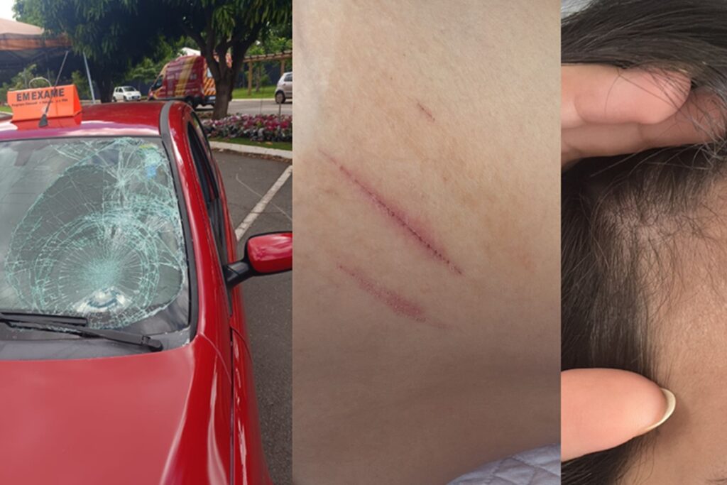 jovem-atropelada-em-exame-de-cnh-desabafa:-“pensei-que-nao-ia-escapar”.-veja-video