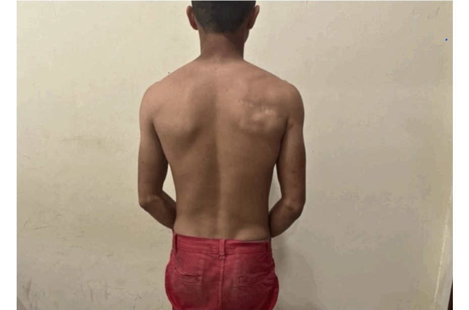 Homem suspeito de tentar matar ex-companheira é preso no Jordão