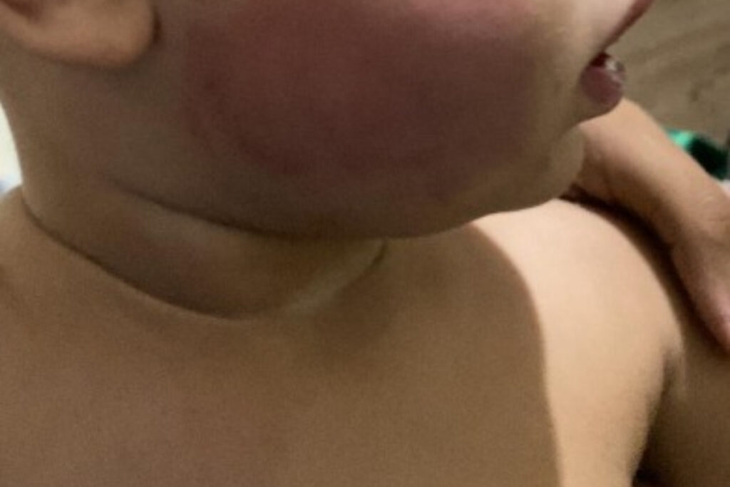 rio:-laudo-confirma-que-bebe-foi-torturado-por-mae-e-padrasto