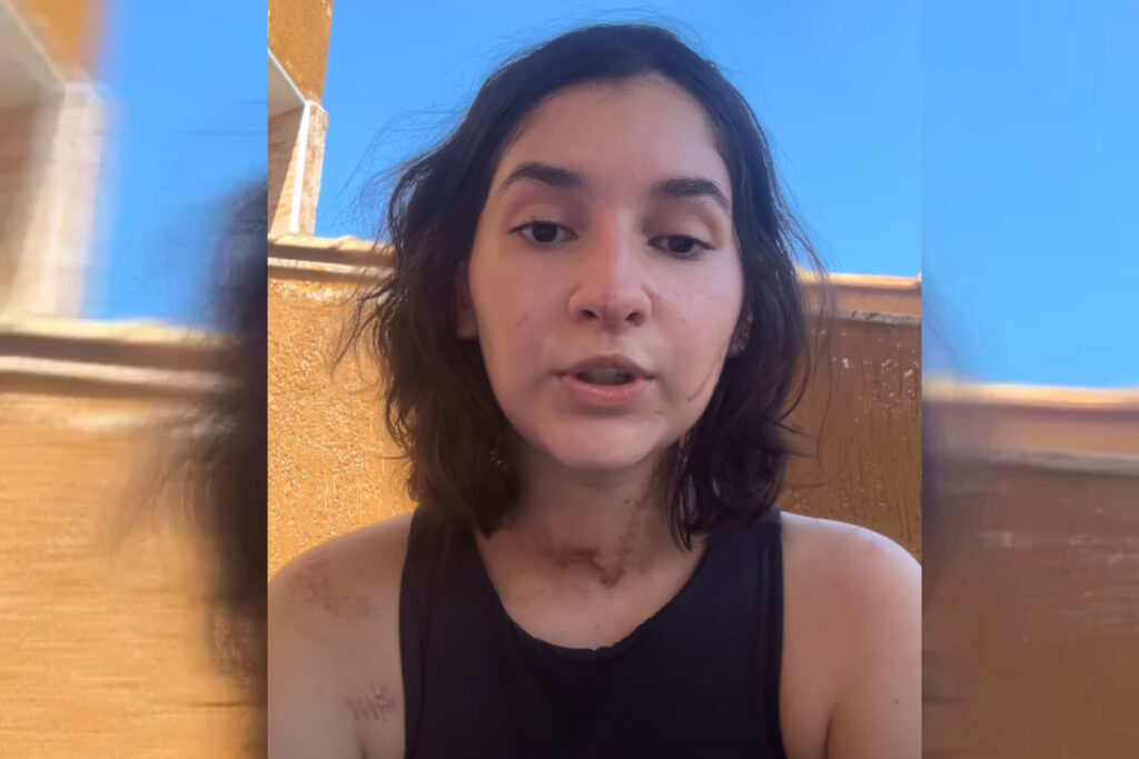 rio:-jovem-esfaqueada-15-vezes-por-negar-namoro-pede-justica-apos-alta