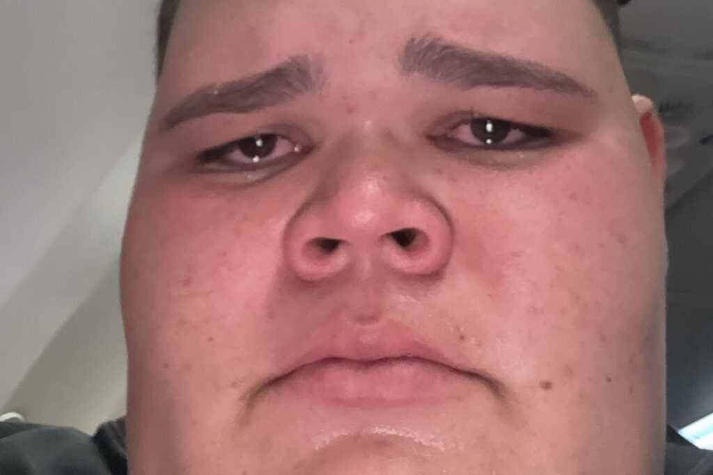 gordao-da-xj-e-internado-e-revela-cirurgia-delicada