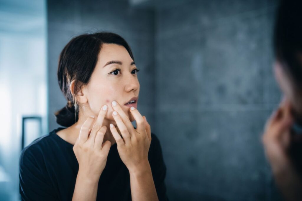 acne-apos-os-40:-entenda-a-relacao-entre-o-metabolismo-e-a-pele-madura