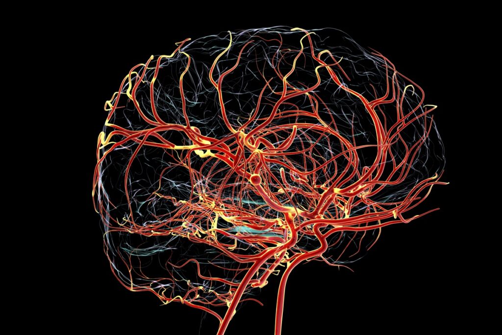 medicas-explicam-importancia-da-alimentacao-na-recuperacao-do-avc