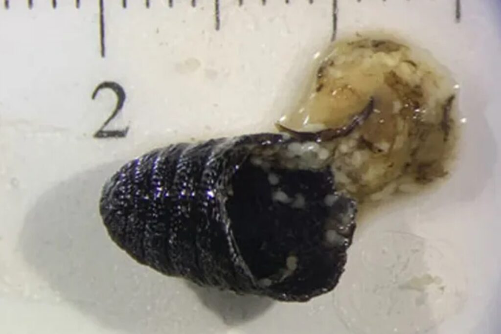 mulher-espirra-“vermes”-pelo-nariz-apos-infeccao-rara