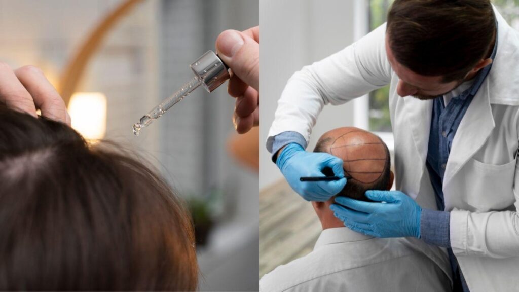 minoxidil-x-implante-capilar:-o-que-e-melhor-para-queda-de-cabelo?