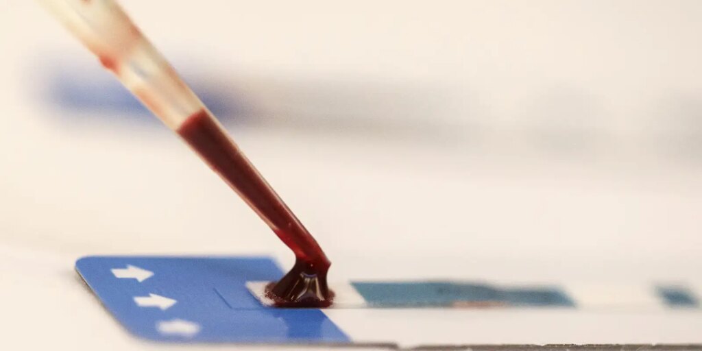 Estudo inédito da Fiocruz pode ampliar prevenção de HIV entre jovens estudo-inedito-da-fiocruz-pode-ampliar-prevencao-de-hiv-entre-jovens