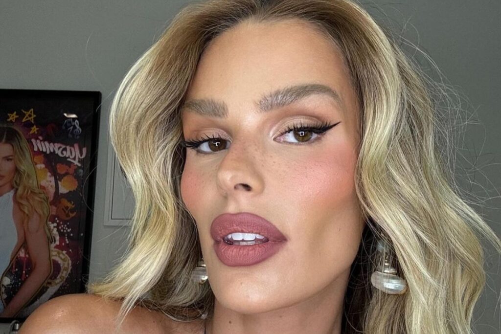 lipedema:-yasmin-brunet-perde-25-kg-e-mostra-antes-e-depois;-veja