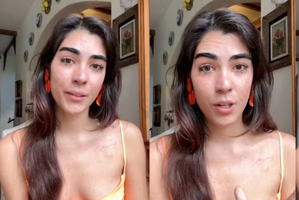 cantora-ananda-paixao-expoe-terceiro-diagnostico-de-cancer-aos-28-anos