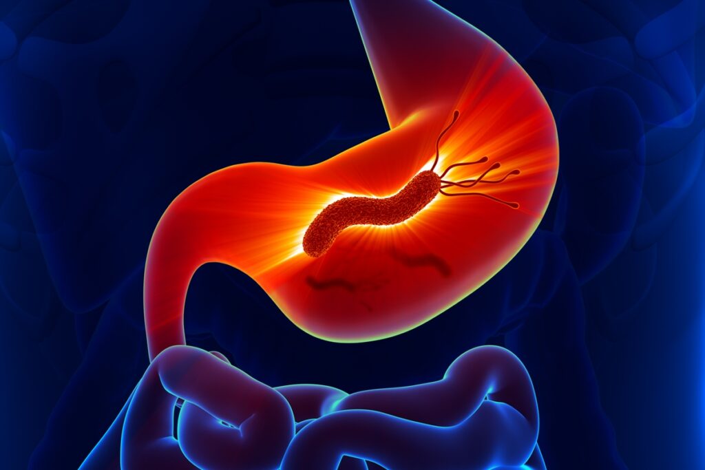 gastroenterologista-cita-sinais-que-uma-pessoa-esta-com-h.-pylori